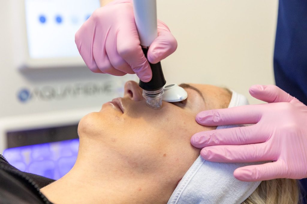 Transform Your Look with Dermal Fillers